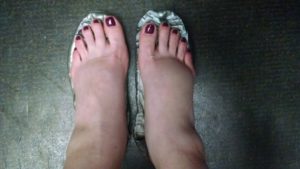 Отекают ноги на 29 неделе беременности