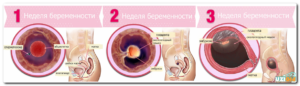 Месячные 2 3 недели беременности