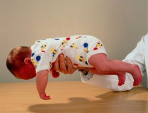 Как снять тонус мышц у ребенка?