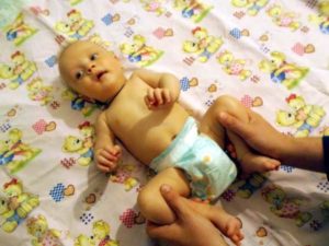 Гипертонус ребенку 5 месяцев