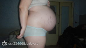 33 Неделя беременности опустился