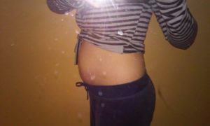 11 Недель беременности сильный токсикоз