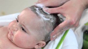 Как убрать корочки у новорожденного на голове?