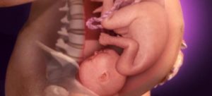 29 Неделя беременности мало шевелений