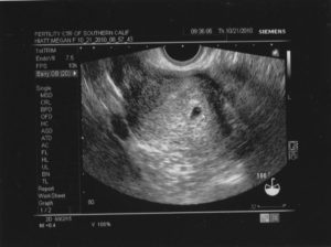 Признаки беременности срок 5 недель