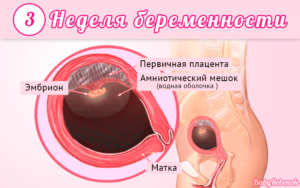 Беременность 3 недели симптомы и признаки