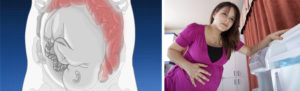 Расстройство кишечника 39 неделе беременности