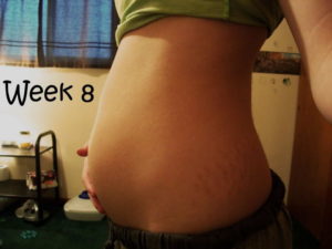 Побаливает живот беременность 8 недель