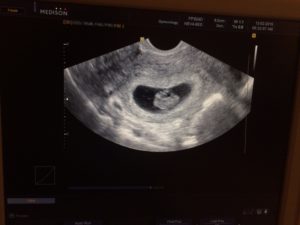 8 Недель узи 6