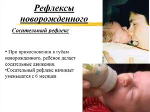 Нарушение сосательного рефлекса у новорожденного