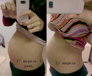 17 Недель беременности каменеет живот