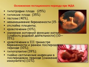 Гипотрофия плода при беременности 34 недель