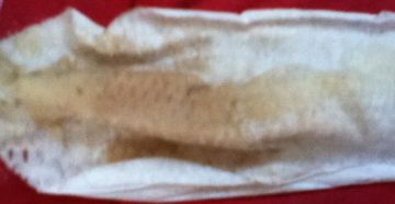 Мазня 2 неделе беременности Мазня 2 неделе беременности