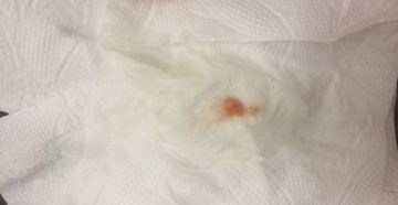 Кровянистые выделения на 7 неделе беременности Кровянистые выделения на 7 неделе беременности