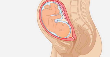 32 Неделя беременности расположение плода