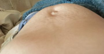 27 Недель беременности боль промежности