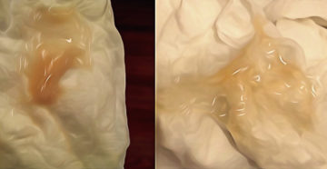 Слизистые выделения 8 неделе беременности