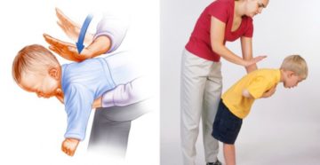 Что делать ребенок подавился? Что делать ребенок подавился?