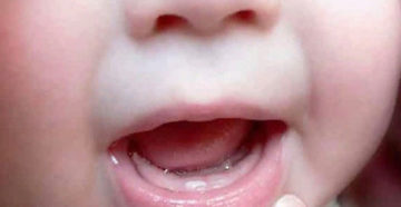 Когда режутся первые зубки у детей Когда режутся первые зубки у детей
