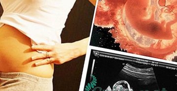 12 Недель беременности болит живот поясница