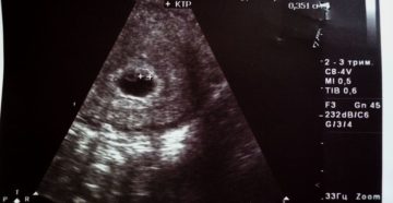 Болит ли живот 7 неделе беременности Болит ли живот 7 неделе беременности