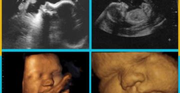 40 акушерских недель беременности 40 акушерских недель беременности