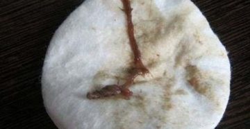 Выделения на 2 неделе беременности после зачатия