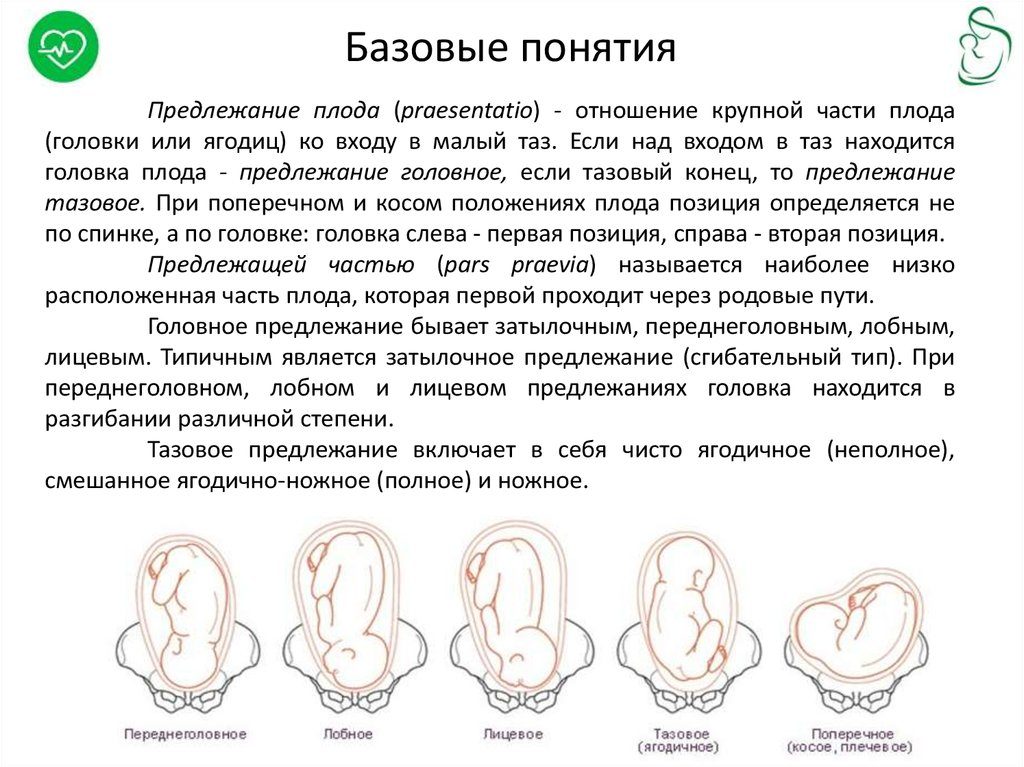 Низкое предлежание плода в 32 недели