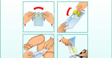 Как взять у ребенка мочу на анализ?