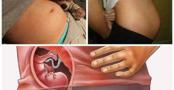 1 неделя беременности ощущения в животе 1 неделя беременности ощущения в животе