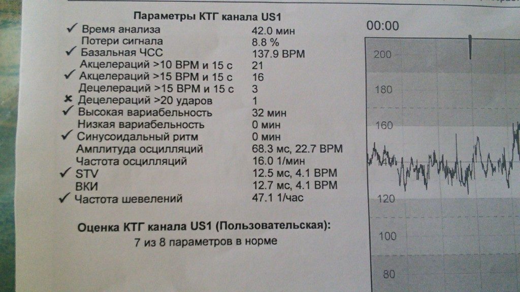 Как расшифровать ктг плода 34 недели