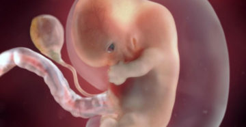 Самочувствие на 8 неделе беременности