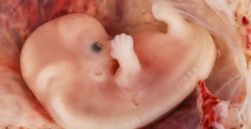 Почему происходит замершая беременность на 8 неделе