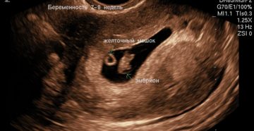 Седьмая неделя беременности форум Седьмая неделя беременности форум