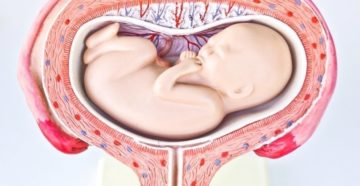 32 Неделя ребенок лежит поперек