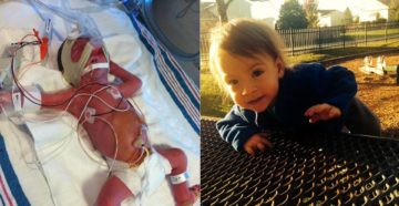 Ребенок родился 27 неделе беременности