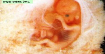 Десятая неделя от зачатия беременности Десятая неделя от зачатия беременности