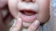 Первые зубы во сколько лезут