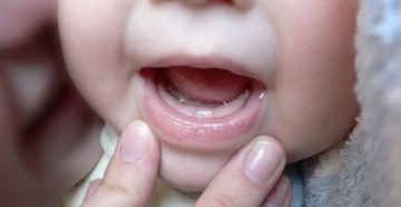Первые зубы во сколько лезут