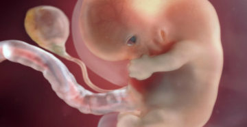 Выглядит плод 8 9 недель