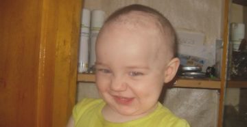 Почему не растут волосы у детей? Почему не растут волосы у детей?