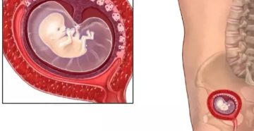 8 Недель тянет низ живота