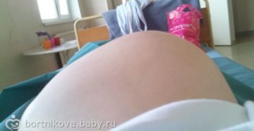 Напряжен живот 2 неделя беременности