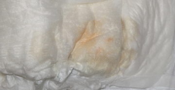 2 Недели беременности идут выделения 2 Недели беременности идут выделения