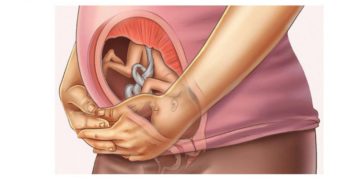 Тонус матки на 27 неделе беременности