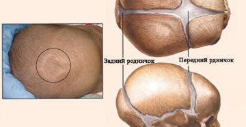 Где родничок у ребенка Где родничок у ребенка