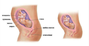 27 Недель и 2 дня беременности