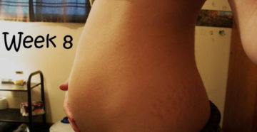 Побаливает живот беременность 8 недель