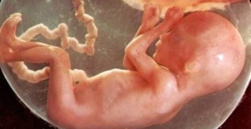 19 недель акушерских беременности 19 недель акушерских беременности