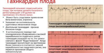 Тахикардия плода на 35 неделе